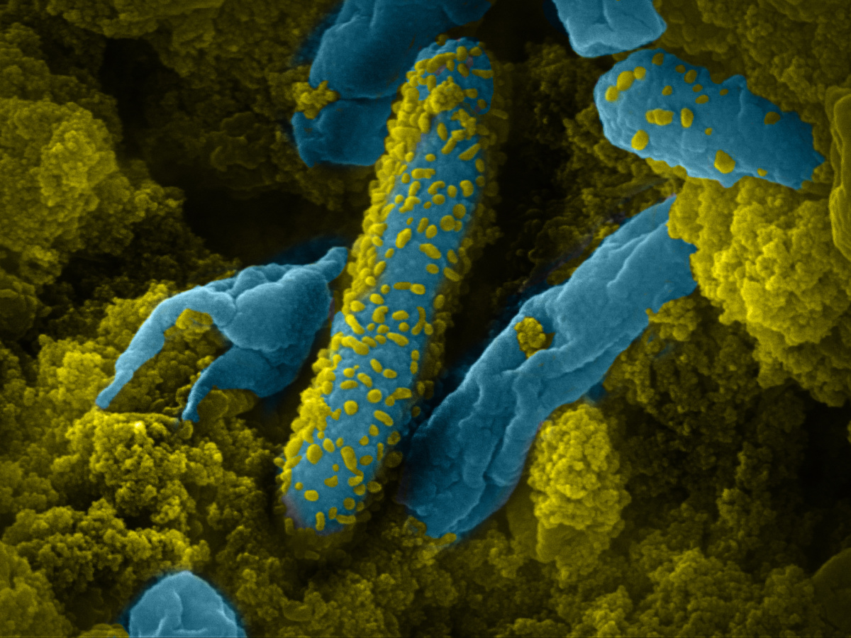 Anaerobic bacteria for a sustainable world · Yerun